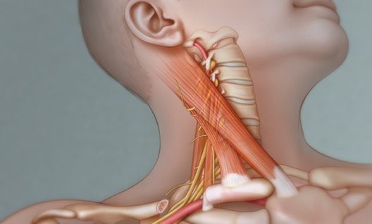 Link to Musculoskeletal Issues